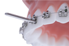 LIFE SAVER BUR (PK5)