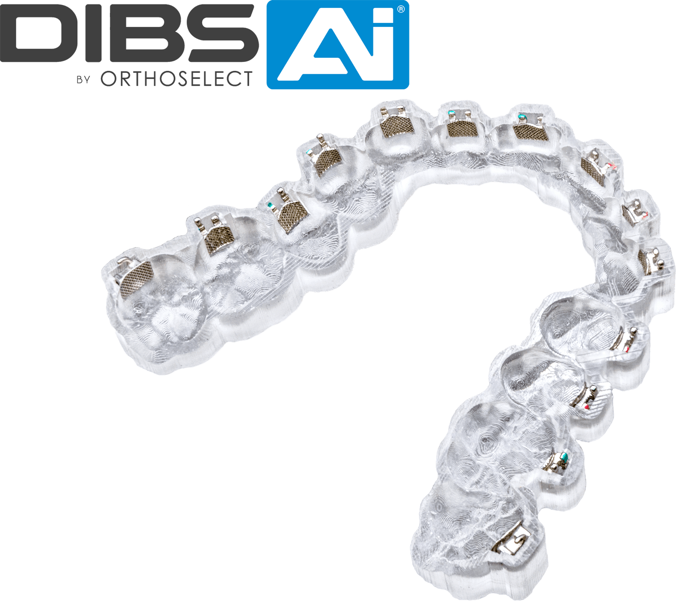 Digital Indirect Bonding (DIBS) with AI
