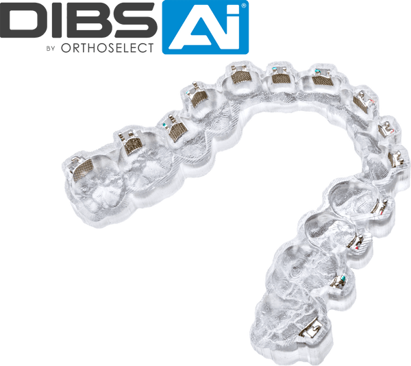 Digital Indirect Bonding (DIBS) with AI