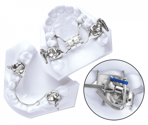 MARA Appliance Main Orthodontics mara-appliance-main-orthodontics