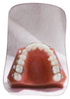 INTRA-ORAL PHOTOGRAPHY MIRRORS