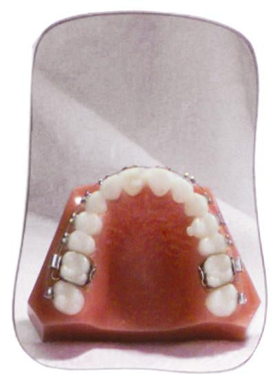 INTRA-ORAL PHOTOGRAPHY MIRRORS
