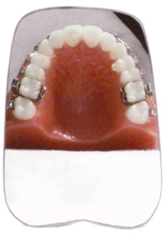 INTRA-ORAL PHOTOGRAPHY MIRRORS