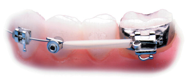 ARCHWIRE SLEEVE CLEAR