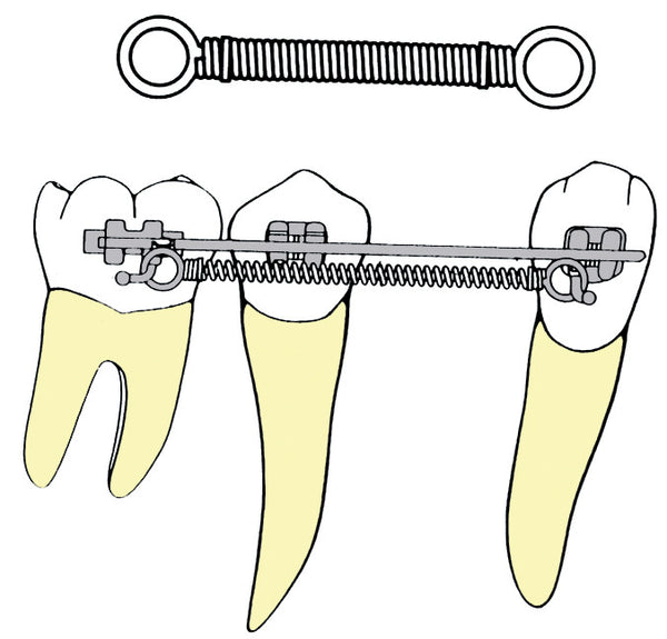 NICKEL TITANIUM POWER CLOSING SPRING