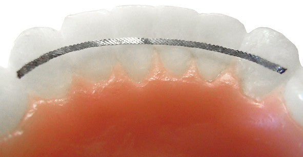 Ultra-Flex Lingual Retainer