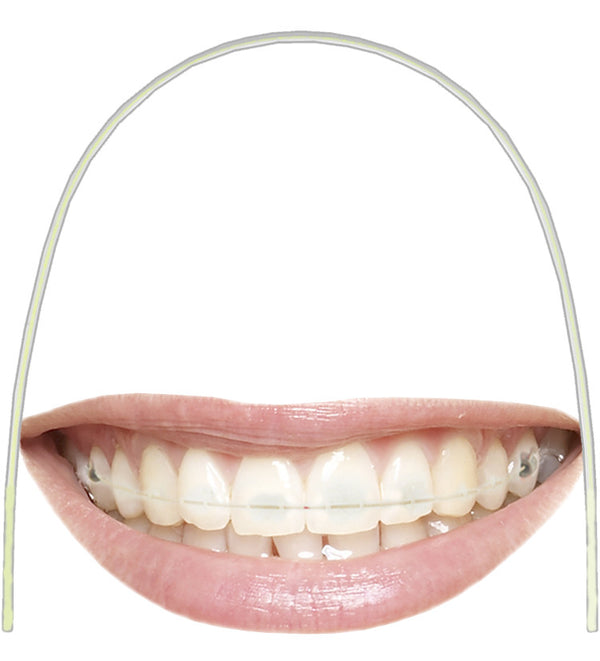 EUROFORM TOOTH COLOURED SUPER ELASTIC NICKEL TITANIUM ARCHWIRES