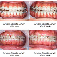 EUROFORM TOOTH COLOURED SUPER ELASTIC NICKEL TITANIUM ARCHWIRES