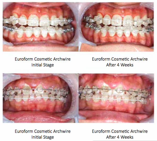 EUROFORM TOOTH COLOURED SUPER ELASTIC NICKEL TITANIUM ARCHWIRES