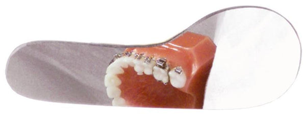 INTRA-ORAL PHOTOGRAPHY MIRRORS