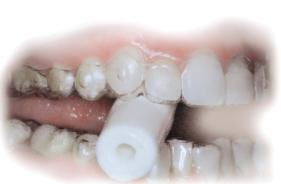 ESSIX® ALIGNER CHEWIES