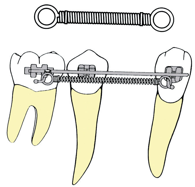NICKEL TITANIUM POWER CLOSING SPRING – Main Orthodontics