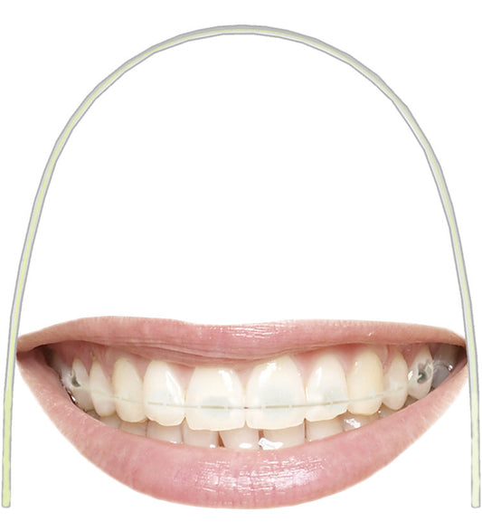 EUROFORM TOOTH COLOURED SUPER ELASTIC NICKEL TITANIUM ARCHWIRES