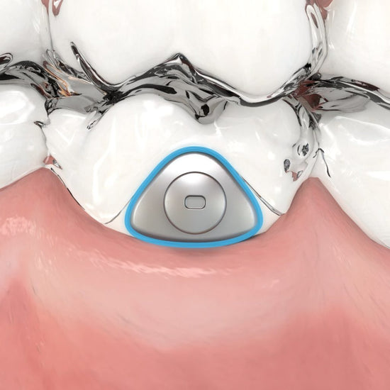PRECISION ALIGNER BUTTONS – Main Orthodontics