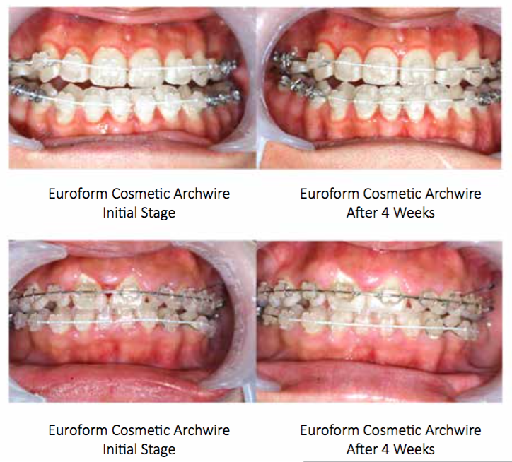 EUROFORM TOOTH COLOURED SUPER ELASTIC NICKEL TITANIUM ARCHWIRES